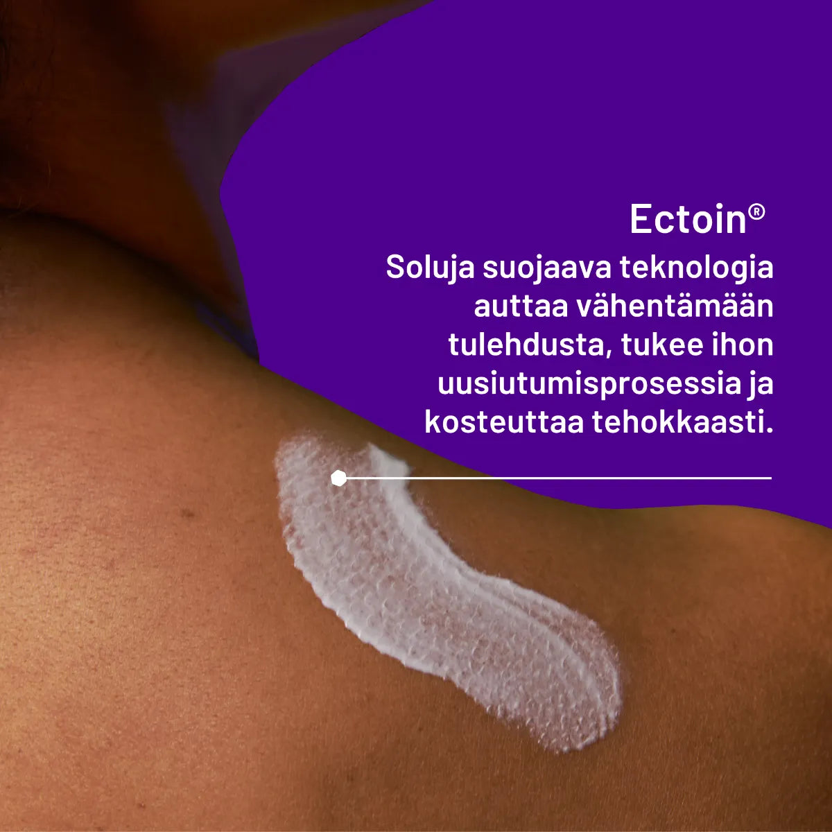 LOCOBASE Psoriasis Cream kortisoniton voide sisältää Ectoin-teknologian, joka suojaa soluja