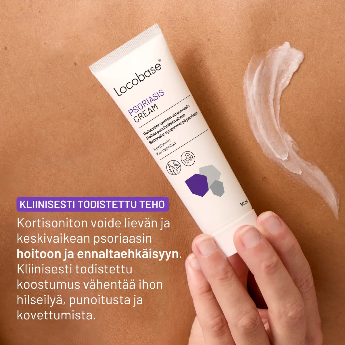 LOCOBASE Psoriasis Cream kortisoniton voide 50 ml kliinisesti todistettu teho